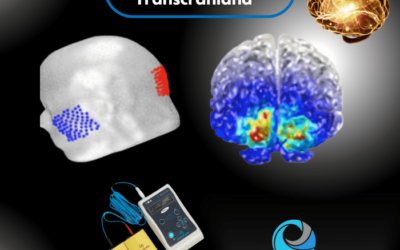 Como funciona o Tratamento Por Estimulação elétrica Transcraniana