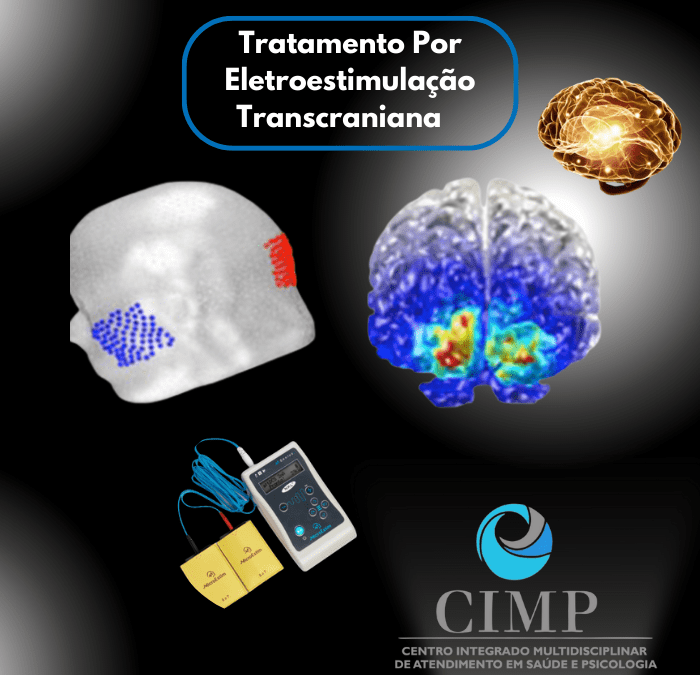 Como funciona o Tratamento Por Estimulação elétrica Transcraniana