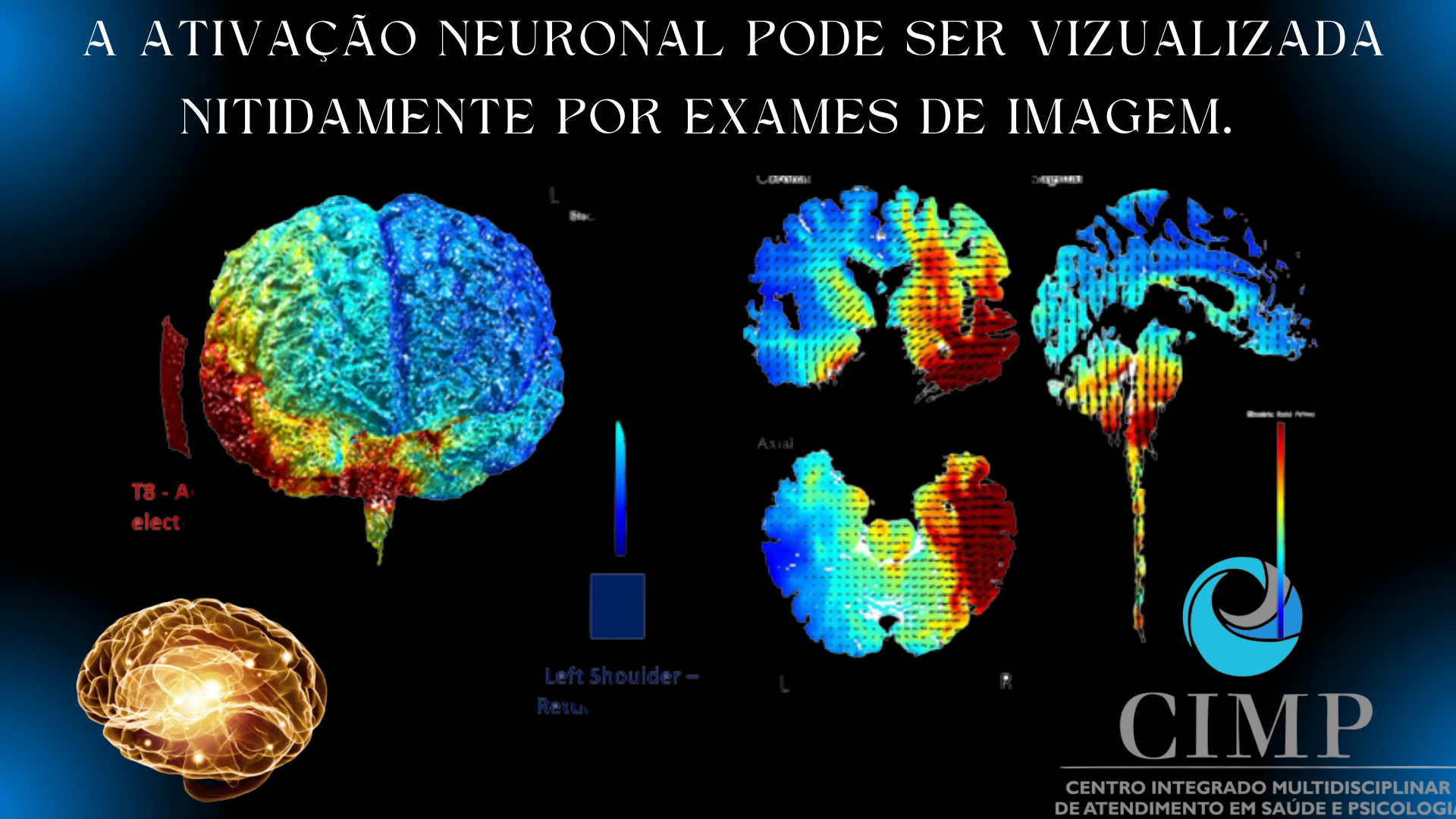 tratamento Por eletroestimulação Transcraniana