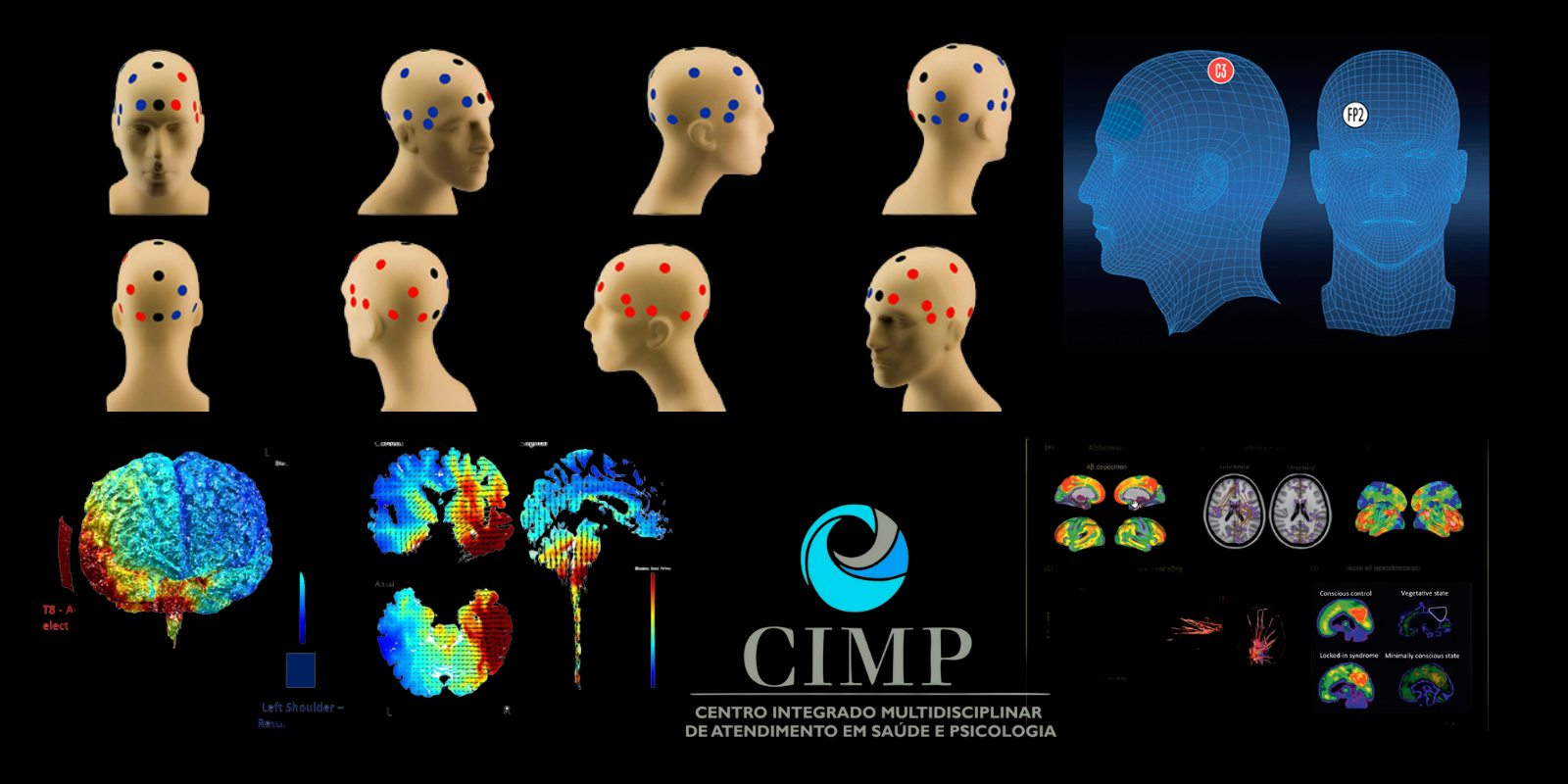 Como então a eletroestimulação transcraniana TDCs irá tratar os adoecimentos? 