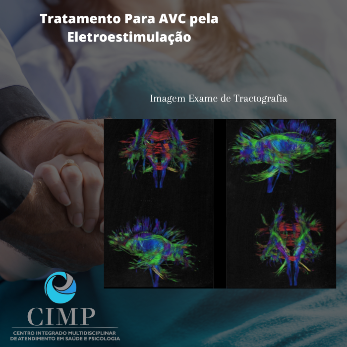 Como é o Tratamento para AVC acidente vascular cerebral pela eletroestimulação transcraniana? 