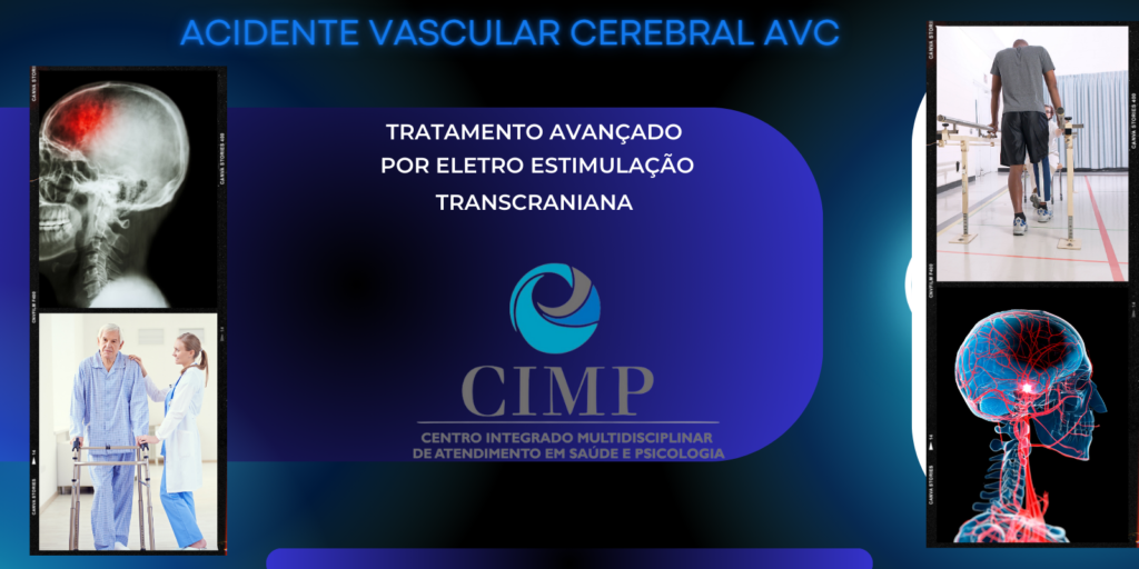 Tratamento do AVC usando a Estimulação elétrica transcraniana