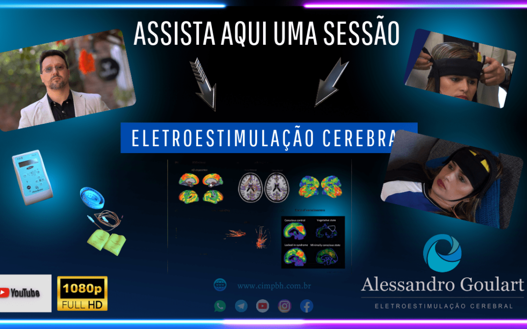 Assista a uma sessão de eletroestimulação cerebral ao vivo