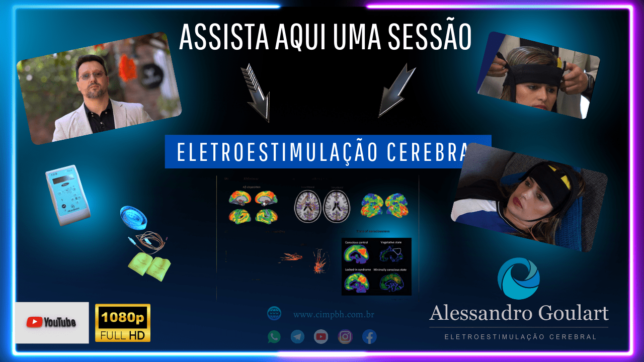 Você que ainda tem alguma dúvida ou receio para começar o seu tratamento por eletroestimulação transcraniana esse vídeo foi feito especialmente para você. Nesse vídeo você irá assistir na integra como é uma sessão de neuromodulação cerebral ou mais conhecido por eletroestimulação transcrnaina. Irá saber sobre como é o funcionamento, inúmeras duvidas serão solucionadas, e o mais importante, terá a partir desse vídeo a certeza que a técnica é completamente segura e que se trás benéficos. Então assista esse vídeo e comece seu tratamento com essa técnica moderna e eficaz que vem ajudando milhões de pessoas a se recuperarem de vez.