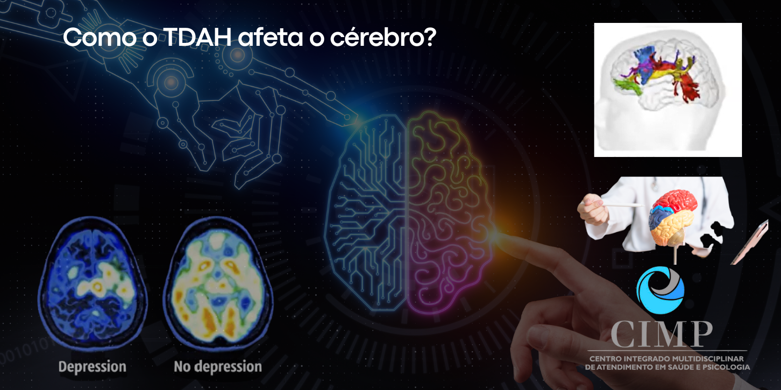 Como o TDAH afeta o cérebro? 