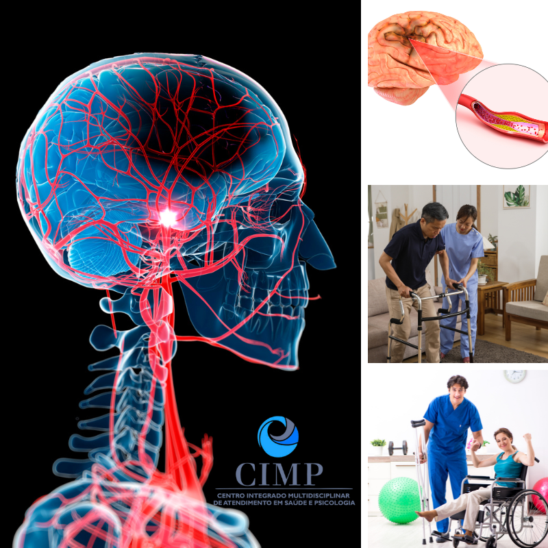 O que é a eletroestimulação cerebral? E como é esse tratamento?<br />
