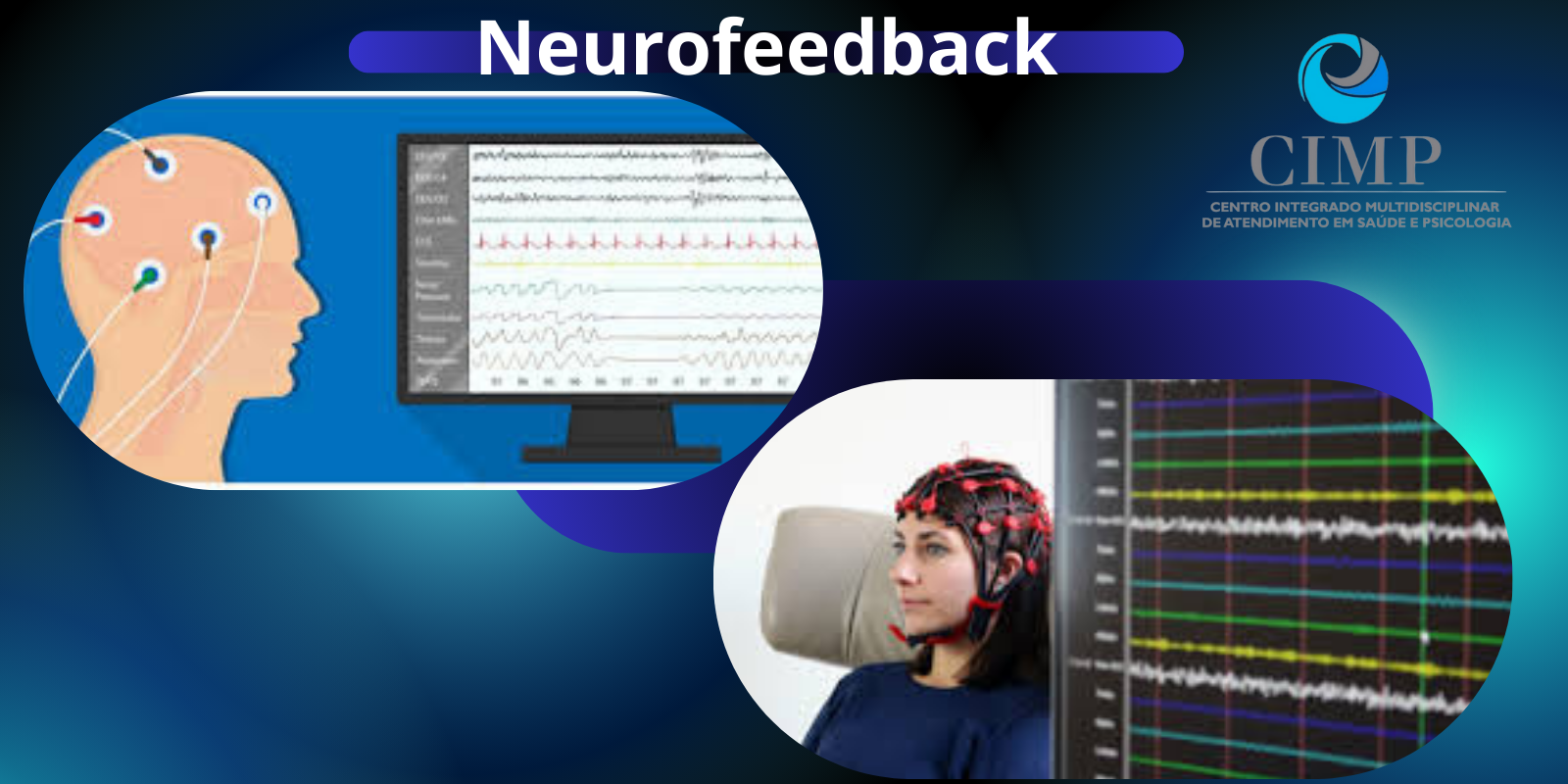 Neurofeedback Melhor tratamento para recuperação de avc em belo horizonte